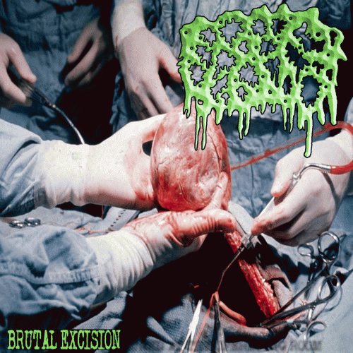 Intestinal Bloating : Brutal Excision